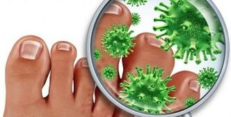 Como tratar unha infección fúngica nos dedos