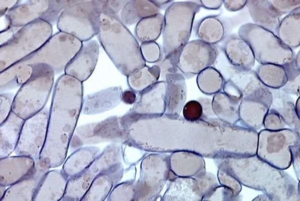 células de fungos das unhas baixo un microscopio
