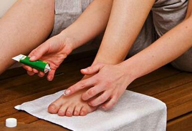 aplicar pomada para tratar a fungo das unhas dos pés